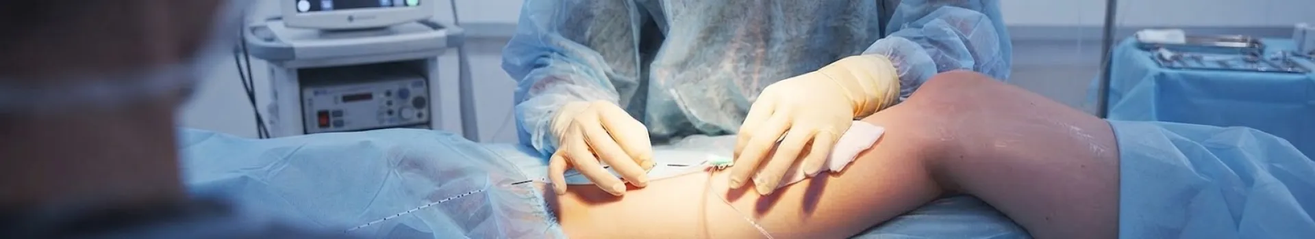 chirurgie vasculaire